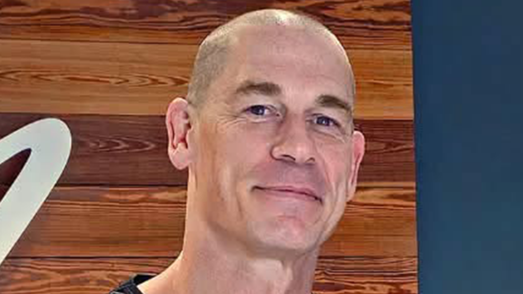 John Cena Goes Bald for Hair Transplant Spherical 2
