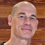 John Cena Goes Bald for Hair Transplant Spherical 2