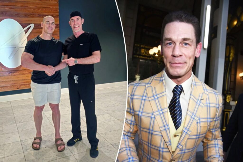 John Cena posts surprising bald picture as a part of hair transplants