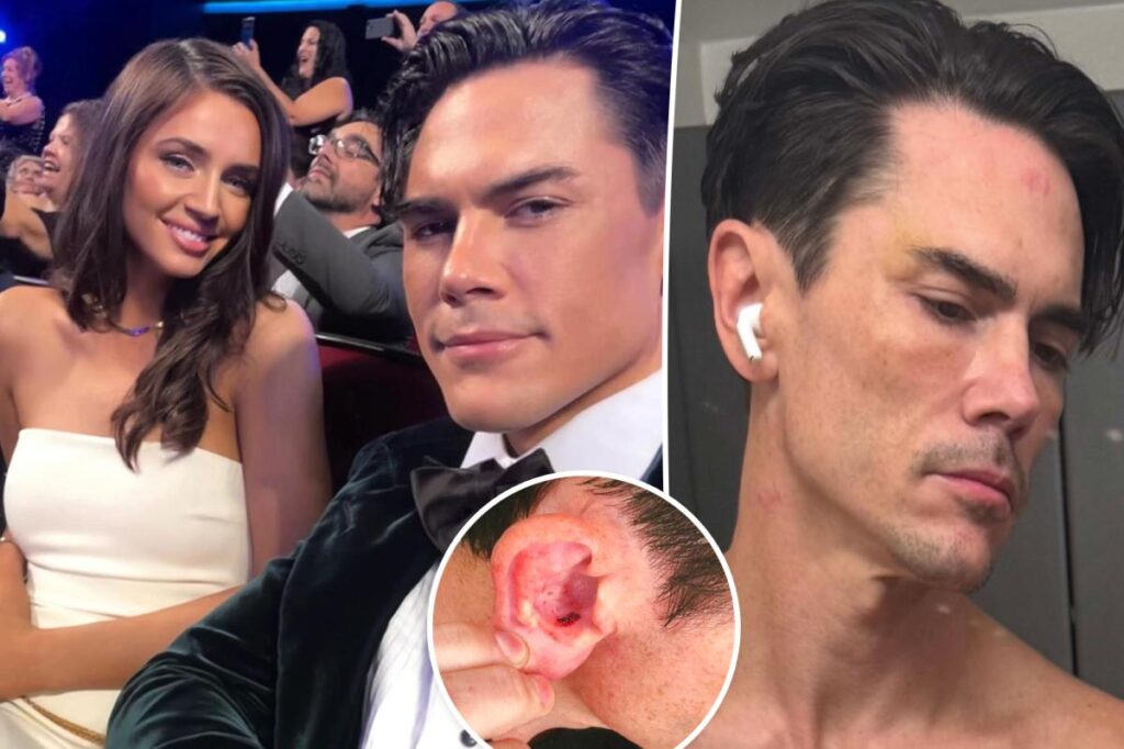 Tom Sandoval’s girlfriend Victoria Robinson arrested for alleged assault that left Bravo star bloody, bruised